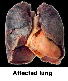 Affected lung