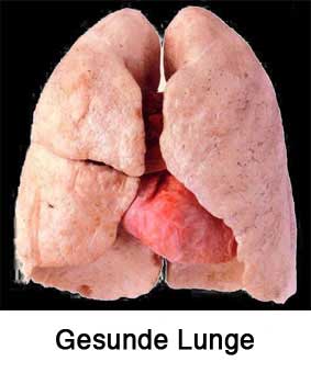 Gesunde Lunge