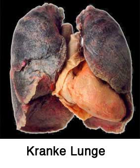 Kranke Lunge